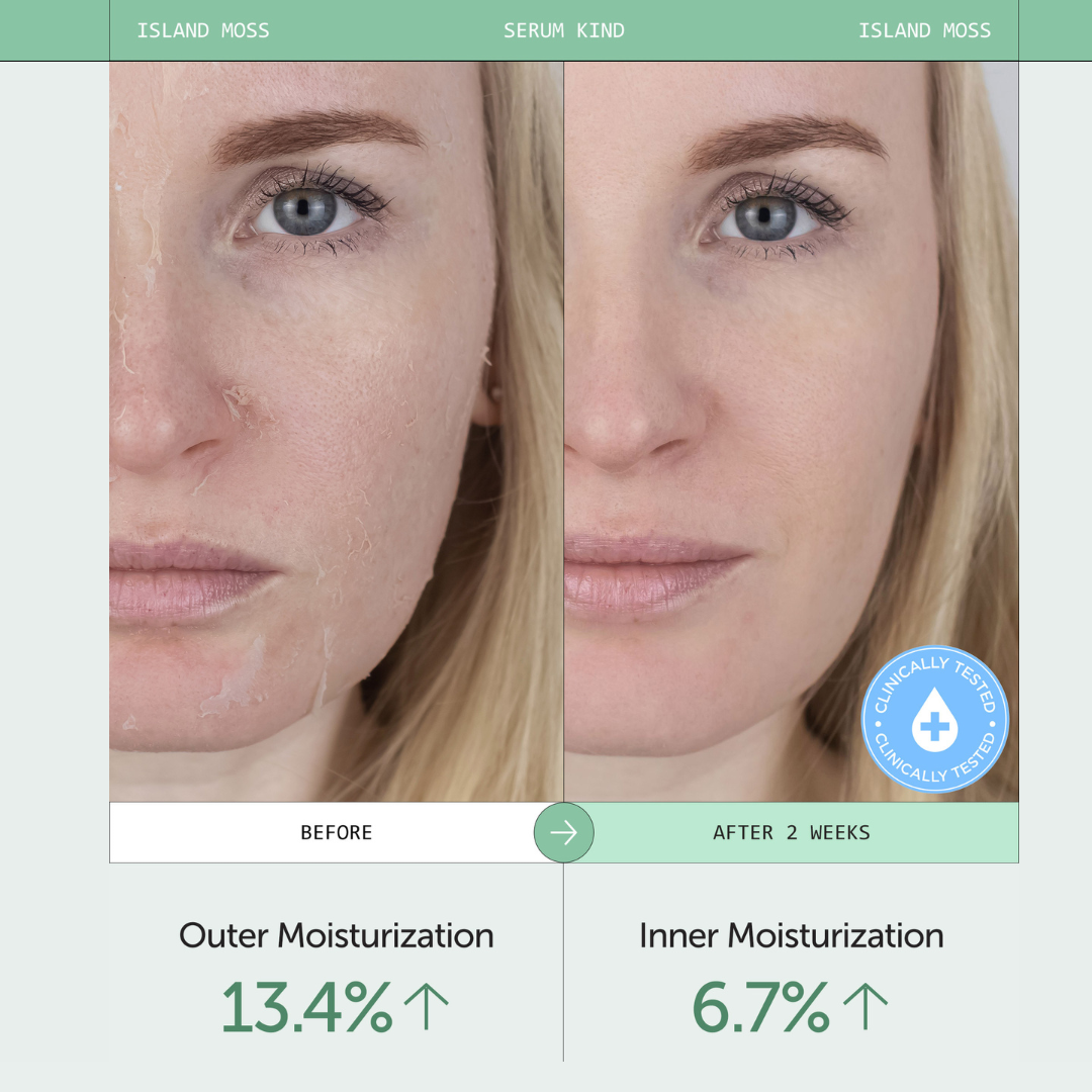 Serumkind Iceland Moss Serum 30ml