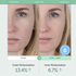 Serumkind Iceland Moss Serum 30ml