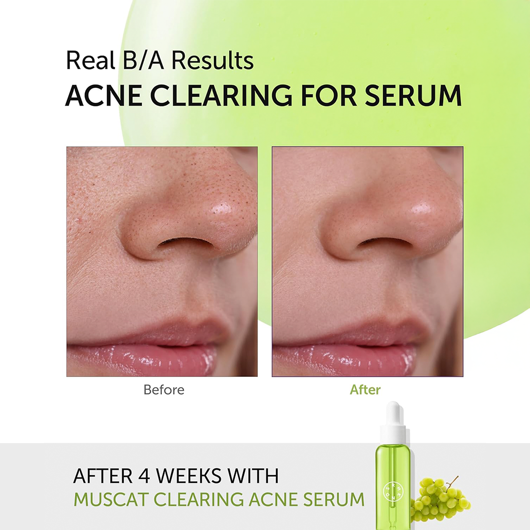 Serumkind Muscat Clearing Serum 30ml