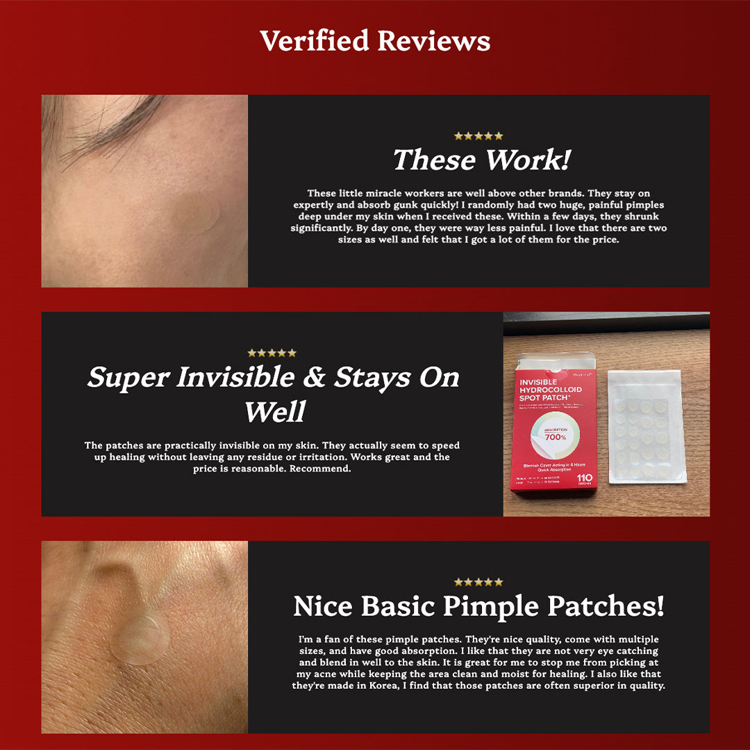 Pimple Lab Invisible Hydrocolloid Spot Patch / Pimple Patch (110 Patches)